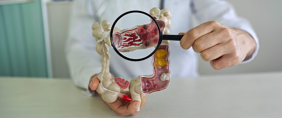 What is Colorectal Surgery-img